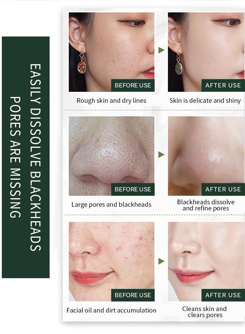 100ml Blackhead Moisturizing Basic Oil Skin Care Facial Basic Massage Oil