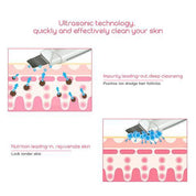 Ultrasonic Skin Scrubber Face Cleanser Blackhead Acne Removal Facial Spa Vibration Massager Ultrasound Peeling Clean Machine 394