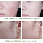 Skin Care Products Face Moisturizing Aloe Vera Gel Cream Acne Treatment Face Cream Sun After Repair Sleeping Mask Face Care Tool