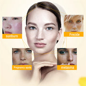 100g Dimollaure Pure 99% Kojic Acid Powder Whitening Cream Removal Freckle Melasma Pigment Melanin Bright Korea Skin Care