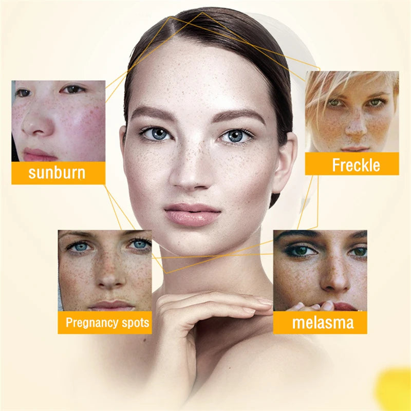 100g Dimollaure Pure 99% Kojic Acid Powder Whitening Cream Removal Freckle Melasma Pigment Melanin Bright Korea Skin Care