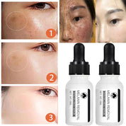Niacinamide Serum Remove Dark Spots Freckle Whitening Moisture Powerful Removal Melasma Chloasma Black Dot Cream Face Skin Care