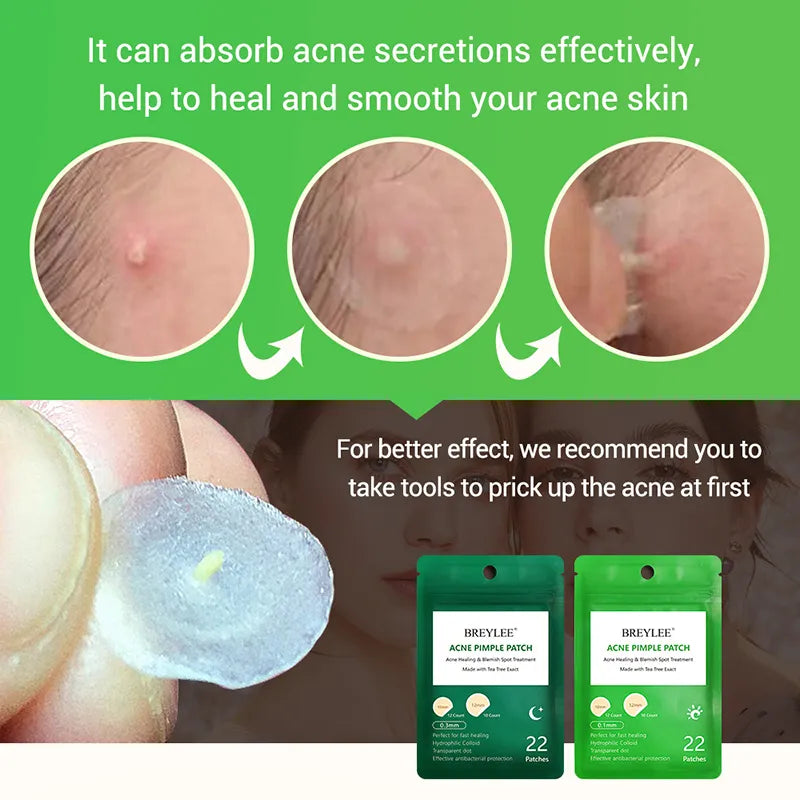 0.1mm Acne Pimple Patch Stickers Waterproof Acne Treatment Pimple Remover Tool Blemish Spot Facial Mask Skin Care 22 patches/bag