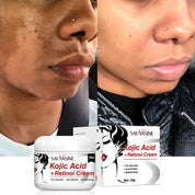 Remove Skin Dark Spots Whitening Face Cream Kojic Acid Anti Aging Retinol Brighten Moisturizing Nourishing Facial Skin Care