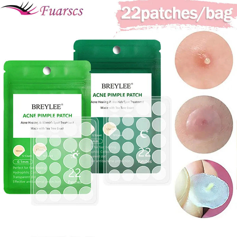 0.1mm Acne Pimple Patch Stickers Waterproof Acne Treatment Pimple Remover Tool Blemish Spot Facial Mask Skin Care 22 patches/bag