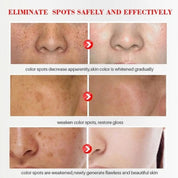 Acne Treatment Face Serum Tea Tree Oil Essence Moisturizing Shrink Pores Acne Facial Serum Korean Skin Care Products