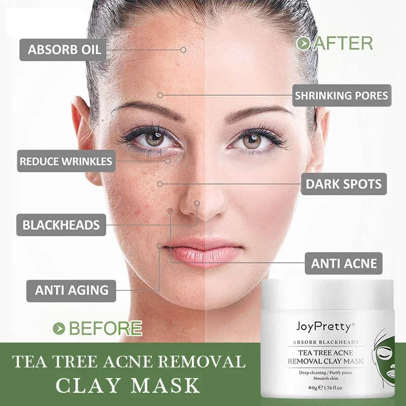 Green Tea Tree Clay Mask Facial Cleans Cream Black Dots Blackheads Remove Mask Against Acne Treatment Cream Sleep Mask Skin Care