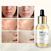 Golden Ampoule Brightening And Firming Moisturizing Lotion