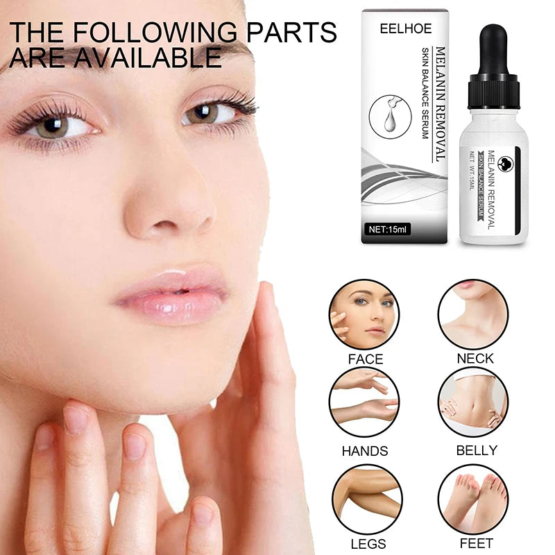 Niacinamide Serum Remove Dark Spots Freckle Whitening Moisture Powerful Removal Melasma Chloasma Black Dot Cream Face Skin Care